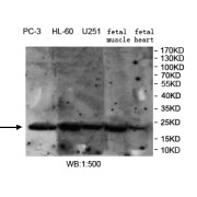 WB analysis of various cell and tissue lysates, using TIMP3 antibody (1/500 dilution).