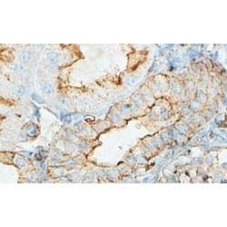 Beta-Actin-Like Protein 2 (ACTBL2) Antibody