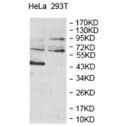Western blot analysis of HeLa (Lane 1) and 293T (Lane 2) cell lysates using Wilms Tumor Protein 1-Interacting Protein (WTIP) Antibody.