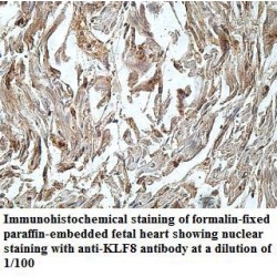 Krueppel-Like Factor 8 (KLF8) Antibody