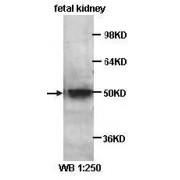 Krueppel-Like Factor 8 (KLF8) Antibody