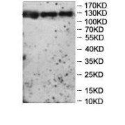 Western blot analysis of 293T (Lane 1), A549 (Lane 2) and Fetal kidney lysates (Lane 3) using A Disintegrin And Metalloproteinase With Thrombospondin Motifs 14 (ADAMTS14) Antibody.