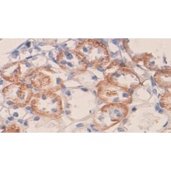 Vascular Endothelial Growth Factor A (VEGFA) Antibody