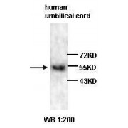 Western blot analysis of Human umbilical cord lysate, using Vascular Endothelial Growth Factor A Antibody.
