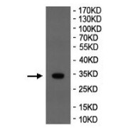 WB analysis of Rat testis tissue lysate, using ARFIP2 Antibody (dilution 1/10000).