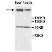 WB analysis of Fetal liver and testis lysates using AGRN antibody (1/500 dilution).