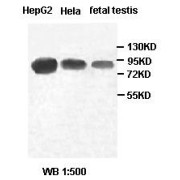WB analysis of HepG2, HeLa and fetal testis lysates, using PIWIL4 antibody (1/500 dilution).