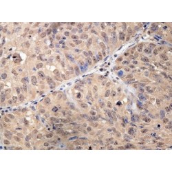 Homeodomain-Only Protein (HOPX) Antibody