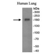 WB analysis of Human lung tissue lysate, using ABCA3 Antibody (1/500 dilution).