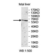 Western blot analysis of fetal liver lysate, using UGT1A1 antibody.