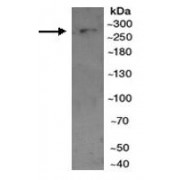 WB analysis of Mouse pancreas tissue lysate, using MTOR antibody (1/300 dilution).