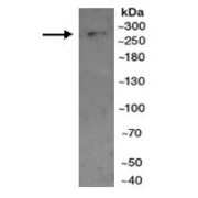 WB analysis of Mouse pancreas tissue lysate, using MTOR antibody (1/300 dilution).