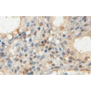 Immunohistochemical staining of formalin-fixed paraffin-embedded Placenta showing nuclear staining with anti-DDX5 antibody at a dilution of 1/100.