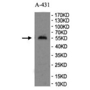 WB analysis of extracts of A-431 cell lysate, using FXR Antibody (1/500 dilution).