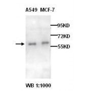 Western blot analysis of A549 and MCF-7 cell lysates, with Alpha 1D Adrenergic Receptor (ADRA1D) Antibody.