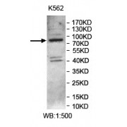 WB analysis of K562 lysates, using NSUN7 antibody.