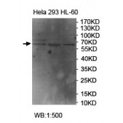WB analysis of HeLa, 293 and HL-60 lysates, using HAS2 antibody (1/500 dilution).