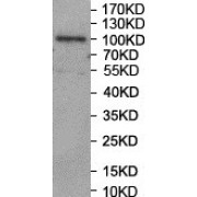 WB analysis of SW620 cell lysates, using PSMD1 antibody.