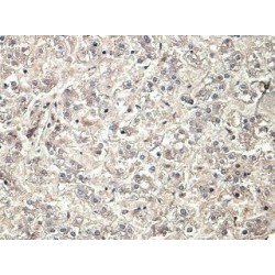 Protease, Serine 23 (PRSS23) Antibody