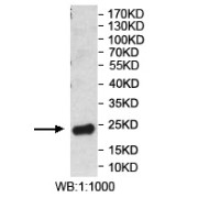 WB analysis of the recombinant protein, using PRSS23 antibody (1/1000 dilution).