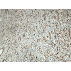 TBC1 Domain Family Member 13 (TBC1D13) Antibody