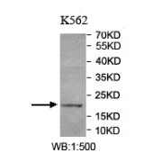 WB analysis of K562 lysates, using TIFA antibody (1/500 dilution).