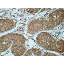 Protein Furry Homolog-Like (FRYL) Antibody