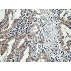 Oxidative Stress-Induced Growth Inhibitor 2 (OSGIN2) Antibody