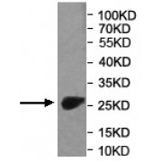 WB analysis of the recombinant protein, using RDH12 antibody (1/500 dilution). Predicted band size: 25 kDa.