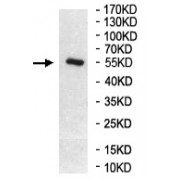 WB analysis of brain tissue lysate, using ST8SIA1 antibody (1/200 dilution).