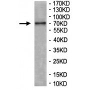 WB analysis of A549 cell lysates, using CTTN antibody (1/500 dilution).