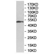 abx145592