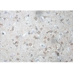 Heat Shock Factor Protein 5 (HSF5) Antibody