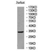 WB analysis of Jurkat cell lysate using Sulfotransferase 1A1 (SULT1A1) antibody.