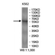 WB analysis of K562 cell lysates, using KPNA4 antibody (1/1000 dilution).