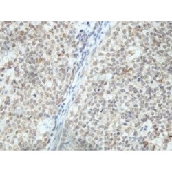 CST Complex Subunit STN1 (OBFC1) Antibody