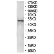 WB analysis of HUVEC cell lysates.