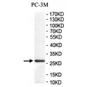 WB analysis of PC-3M cell lysates, using C6orf141 antibody (1/200 dilution).