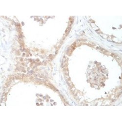 DDB1- and CUL4-Associated Factor 16 (DCAF16) Antibody