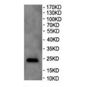 Western blot analysis of HeLa cell lysate, using DDB1- and CUL4-Associated Factor 16 Antibody (1/500 dilution).