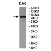 WB analysis of K562 cell lysate, using Neuroendocrine Convertase 1 (PCSK1) Antibody (1/1000 dilution).