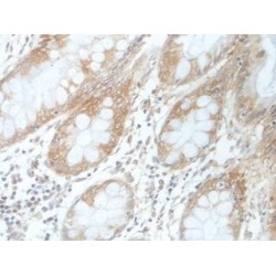 Primary Cilium Assembly Protein FAM149B1 (FAM149B1) Antibody