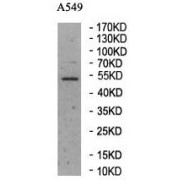 Western blot analysis of A549 lysates, using GSDMD antibody.