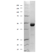 SDS-PAGE analysis of Zika Virus NS1 Protein.