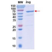 SDS-PAGE analysis of recombinant Human CAT (LOT P2109584Q).