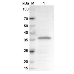 Dystrophin (DMD) Antibody