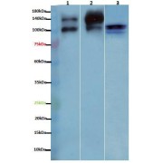 WB analysis of (1) HeLa cell line lysates, (2) SKOV3 cell line lysates transfected with GPC3 plasmid, and (3) MCF-7 cell line lysates. Lysate concentration: 30 µg/lane. Primary antibody: abx124141 (1/1000 dilution). Secondary antibody: HRP-conjugated Goat anti-Mouse IgG (1/10,000 dilution). Predicted band size: 120 kDa. Observed band size: 120 kDa, 100 kDa. Blocking/Dilution buffer: 5% skimmed milk/PBST. Exposure time: 1 min.