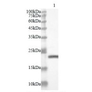 WB analysis of recombinant SARS-CoV-2 Envelope protein lysate (0.5 µg/lane), using SARS-CoV-2 Envelope Protein Antibody (1/4000 dilution). Predicted band size: 21 kDa, Observed band size: 21 kDa.