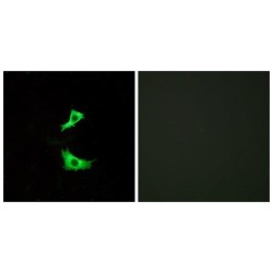 G-Protein Coupled Receptor 41 (GPR41) Antibody
