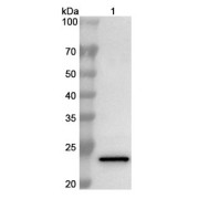 WB analysis of recombinant Laminin Subunit Alpha 5 (LAMA5) protein, using Laminin Subunit Alpha 5 (LAMA5) Antibody (1 µg/ml). Predicted MW: 24 kDa, Observed MW: 24 kDa.